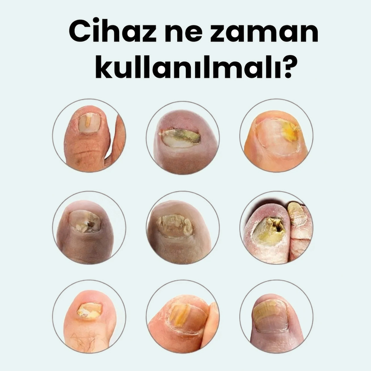 PakTırnak™ Tırnak Bakım Cihazı