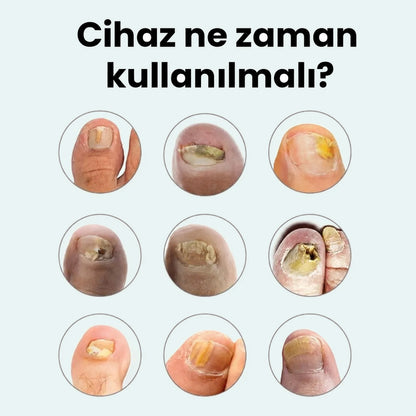 PakTırnak™ Tırnak Bakım Cihazı